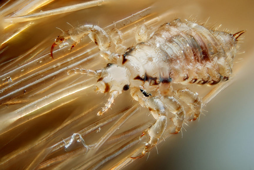 Male_human_head_louse-864x578